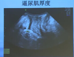 QQ截图20150204162446.jpg