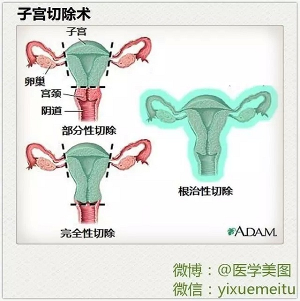 【医美绝伦】妇科医学美图联播