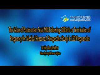 The Value of Postmortem Fetal MRI Following Stillbirth or ...