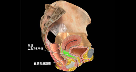 ֱ��������Ĥ